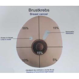 Female breast model for demonstration