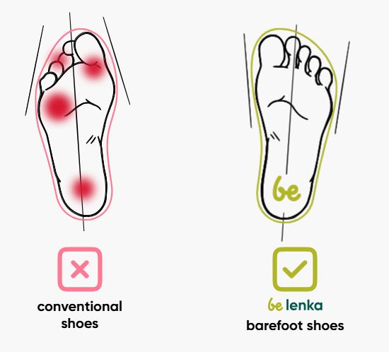 Chaussures ergonomiques vs chaussures normales