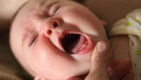 Apparition des premieres dents de bébé