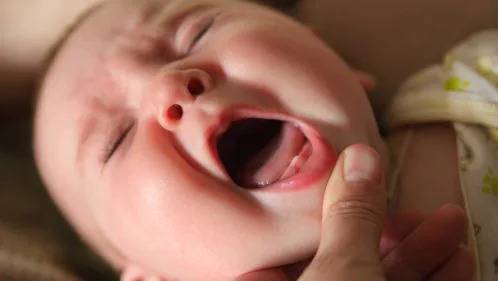 Dents bébé qui percent : Symptômes et soulager bébé.