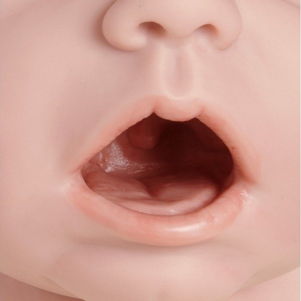 bouche ouverte